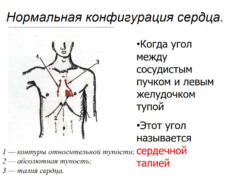 Нормальная конфигурация сердца.  1 — контуры относительной тупости; 2 — абсолютная тупость; 